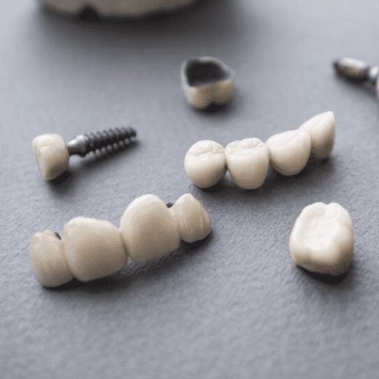 dental crowns in huntsville